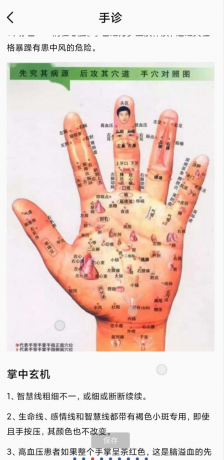 中医舌诊图解大全-第20张图片 中医舌诊图解大全-第20张图片